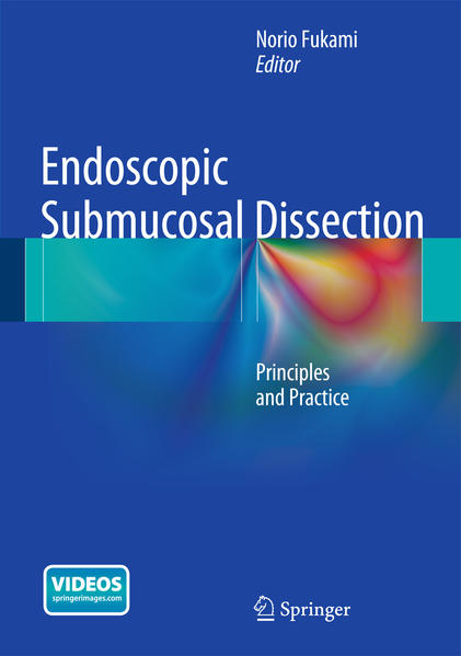 Endoscopic Submucosal Dissection | Gay Books & News