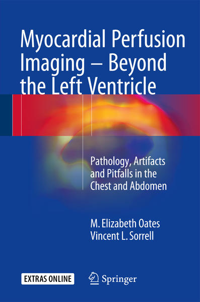 Myocardial Perfusion Imaging - Beyond the Left Ventricle | Gay Books & News